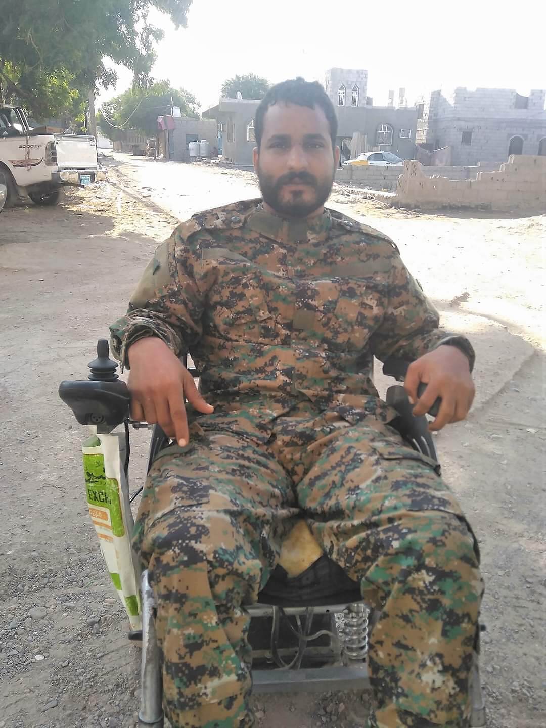 جندي أصيب بطلقة قناص في رأسه في جبهة كرش يعرض كليته للبيع ليتمكن من السفر للخارج للعلاج