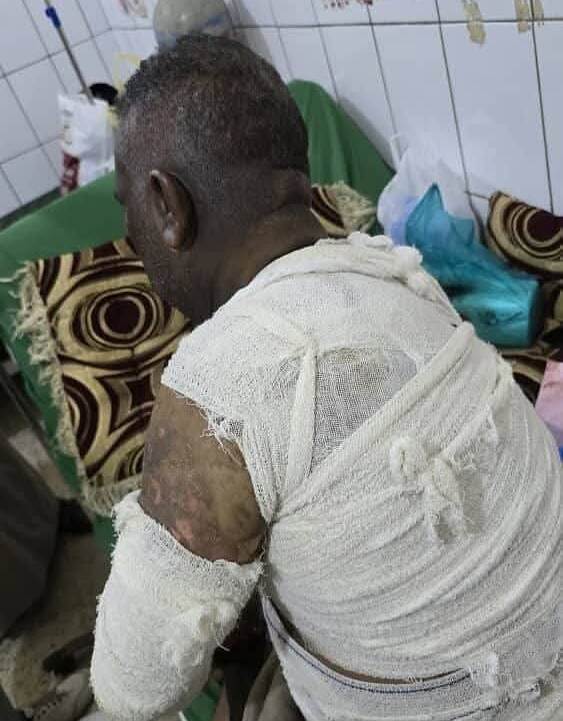 شرطة تعز تلقي القبض على متهمين برش مادة الأسيد على مدير مكتب الصحة في مديرية القاهرة بتعز