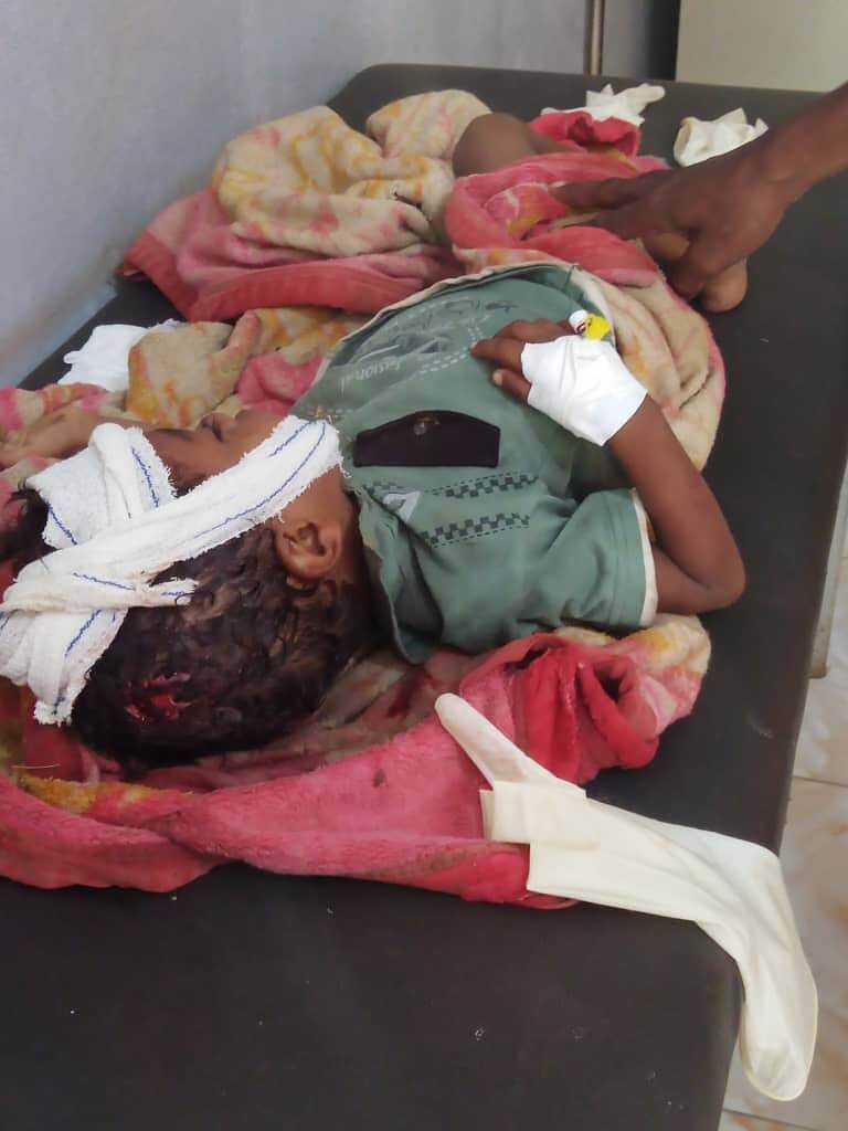 قصف حوثي على  منزل بكر قائد في مقبنة يؤدي لمقتل طفل له وأصابة ثلاثة أخريين