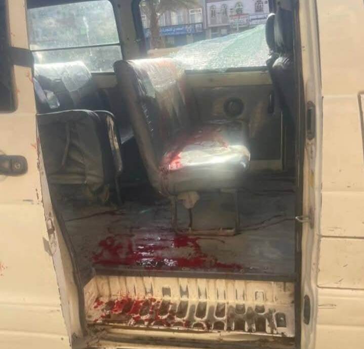 مقتل معلمة على يد زوجها في محافظة عدن بعد اطلاق الرصاص عليها عند توجهها للمدرسة التي تعمل بها