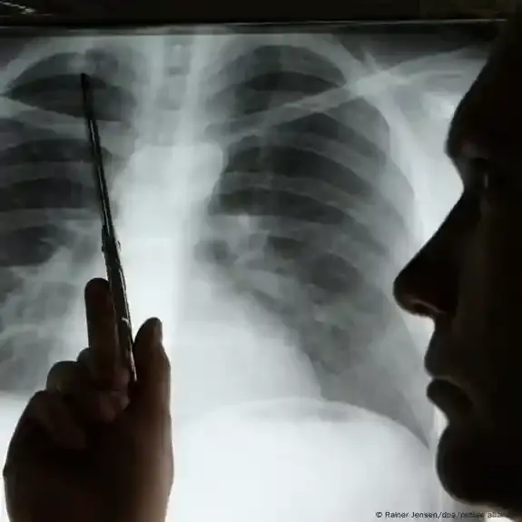 علاج السرطان أكثر قدرة على التحمل بفضل الأشعة فوق البنفسجية..