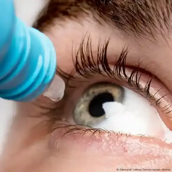 لمواجهة أمراض شبكية العين.. ابتكار قطرة تبطئ فقدان البصر.