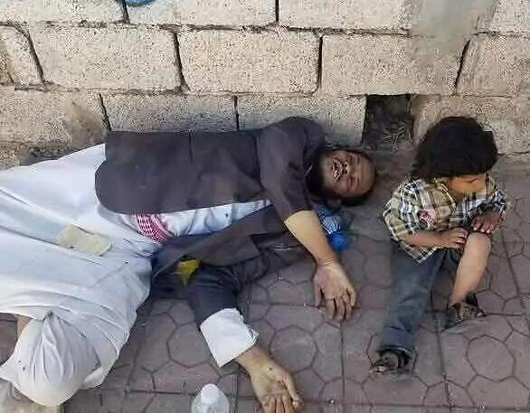 وفاة "البكار" وبجواره طفله تكشف تردي ظروف اليمنيين وسيطرة المجاعة على حياتهم