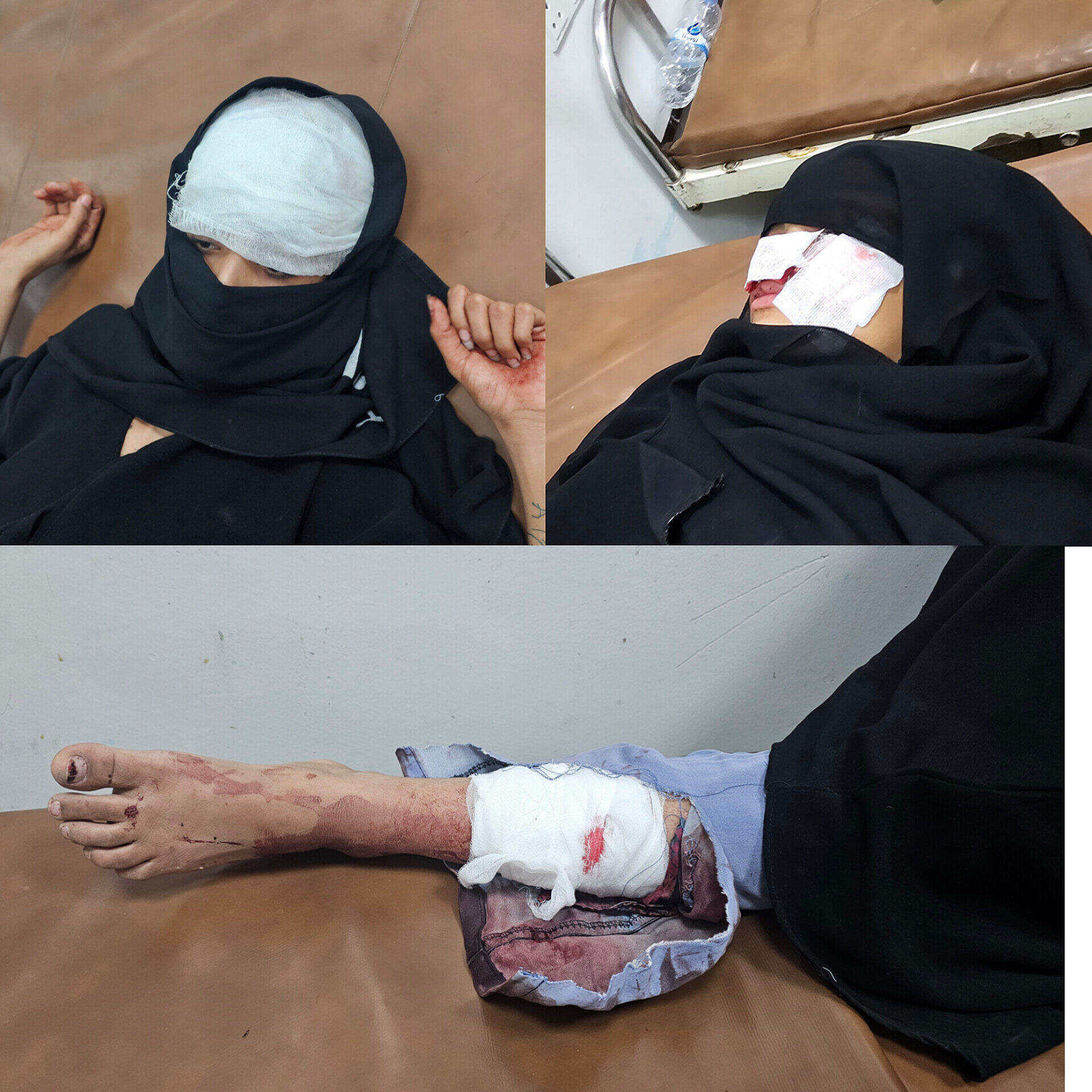 قذيفة أطلقها الحوثيون لوسط محافظة  تعز تؤدي إلى اصابة 3 نساء