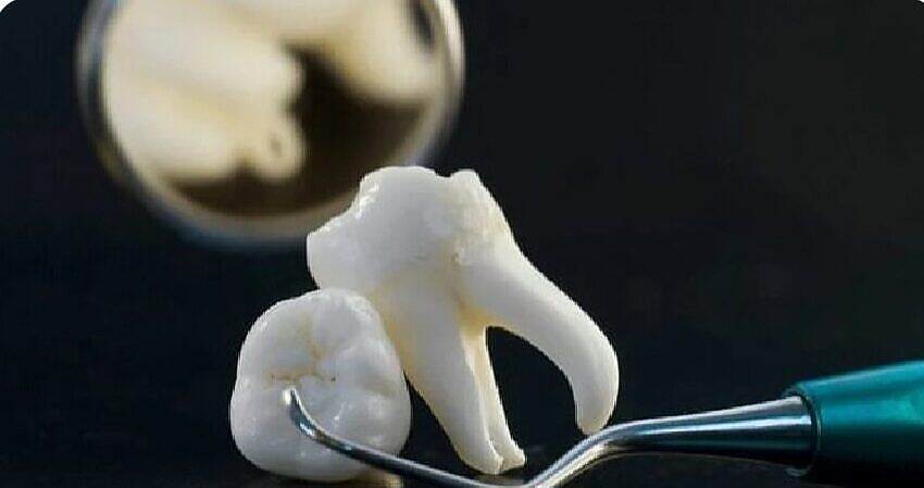 علماء ينجحون  للمرة الأولى في زراعة أسنان بشرية داخل المختبر