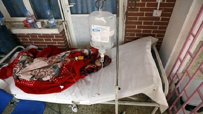 ارتفاع عدد الاطفال المصابين بالحصبة في المحافظات الجنوبية وتخوفات من زيادة الوفيات