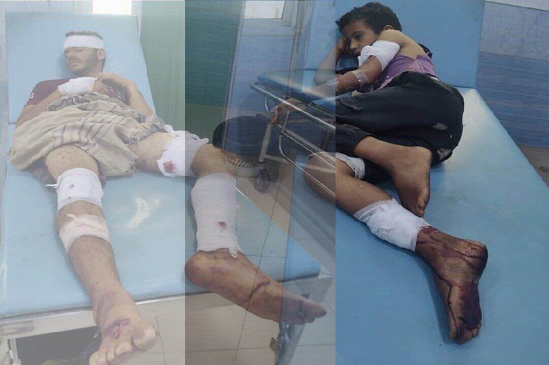 اصابة شقيقان بانفجار عبوة ناسفة من مخلفات جماعة الحوثيين في محافظة تعز