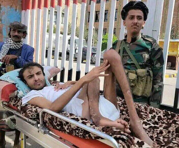 بين الفساد والإهمال.. معاناة جرحى الحرب في تعز تتفاقم في ظل تسيس هذا الملف