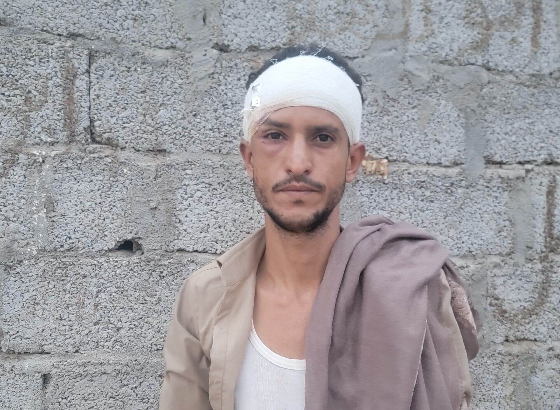 شاب يتهم وجاهات اجتماعية في محافظة لحج بالتدخل لضمان اخراج شخص أعتدى عليه موقوف في سجن العند