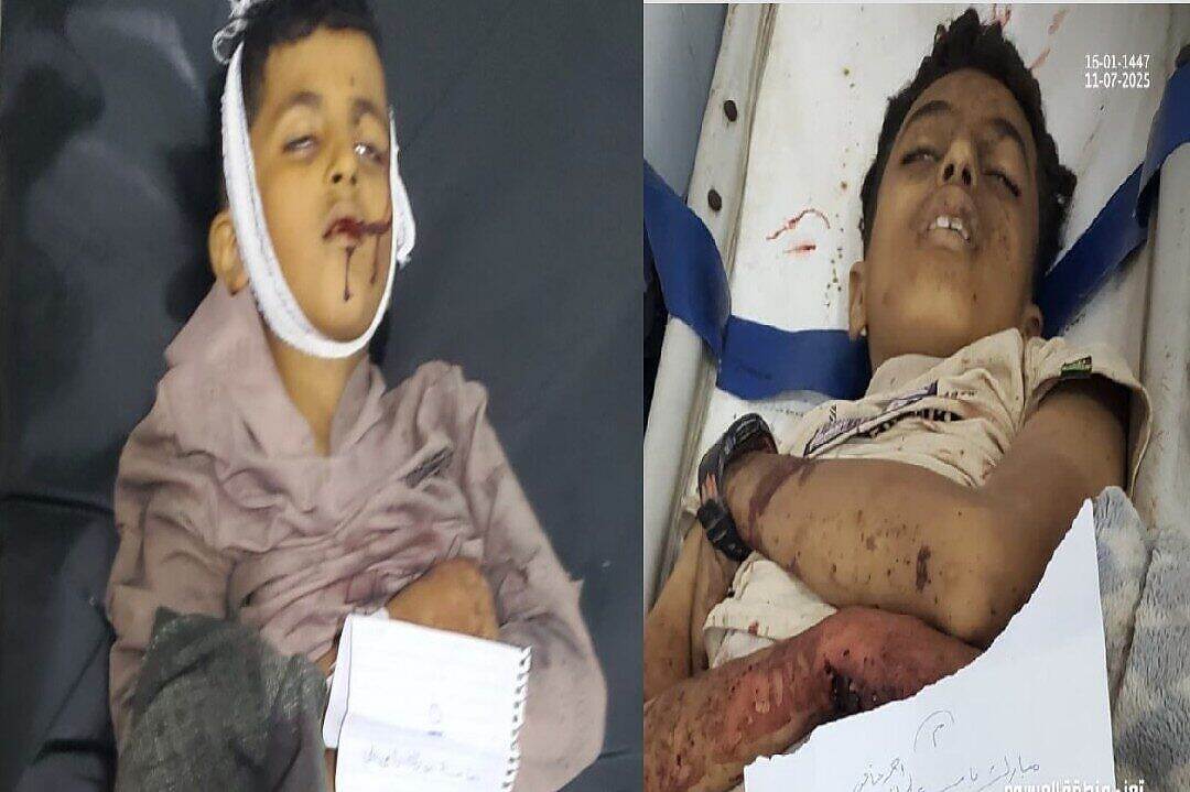 مقذوف ينفجر في مديرية التعزية ويودي بحياة أربعة أطفال أثناء محاولتهم تحريكه