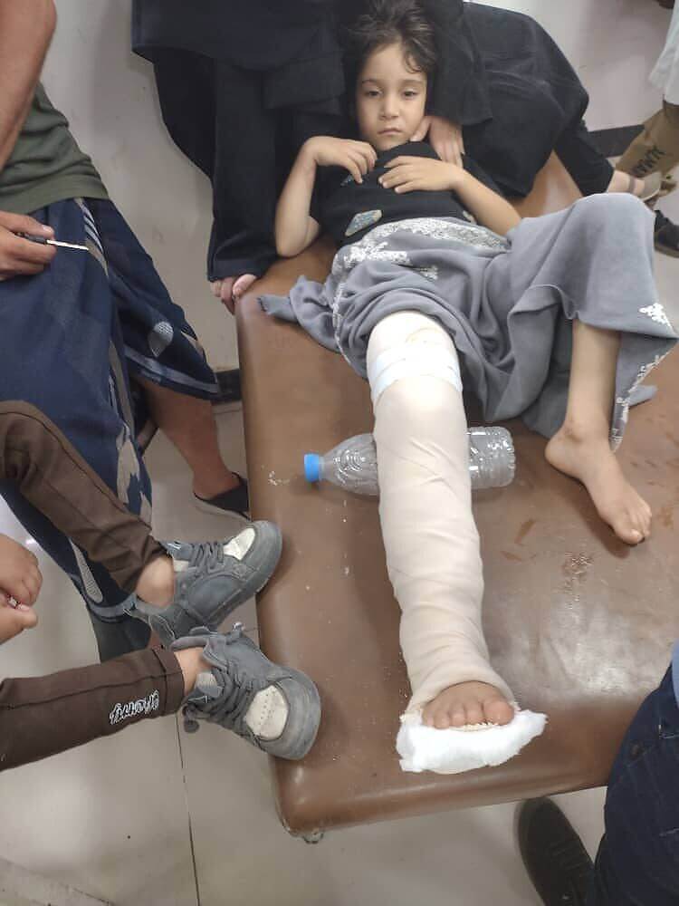 اصابة شاب وطفل برصاصات قناص تبة الأمن المركزي في محافظة تعز