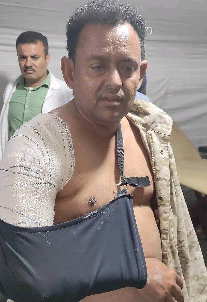 محاولة اغتيال تطال ناشطاً حقوقياً في التربة بتعز ونجاته من إطلاق نار قرب منزله