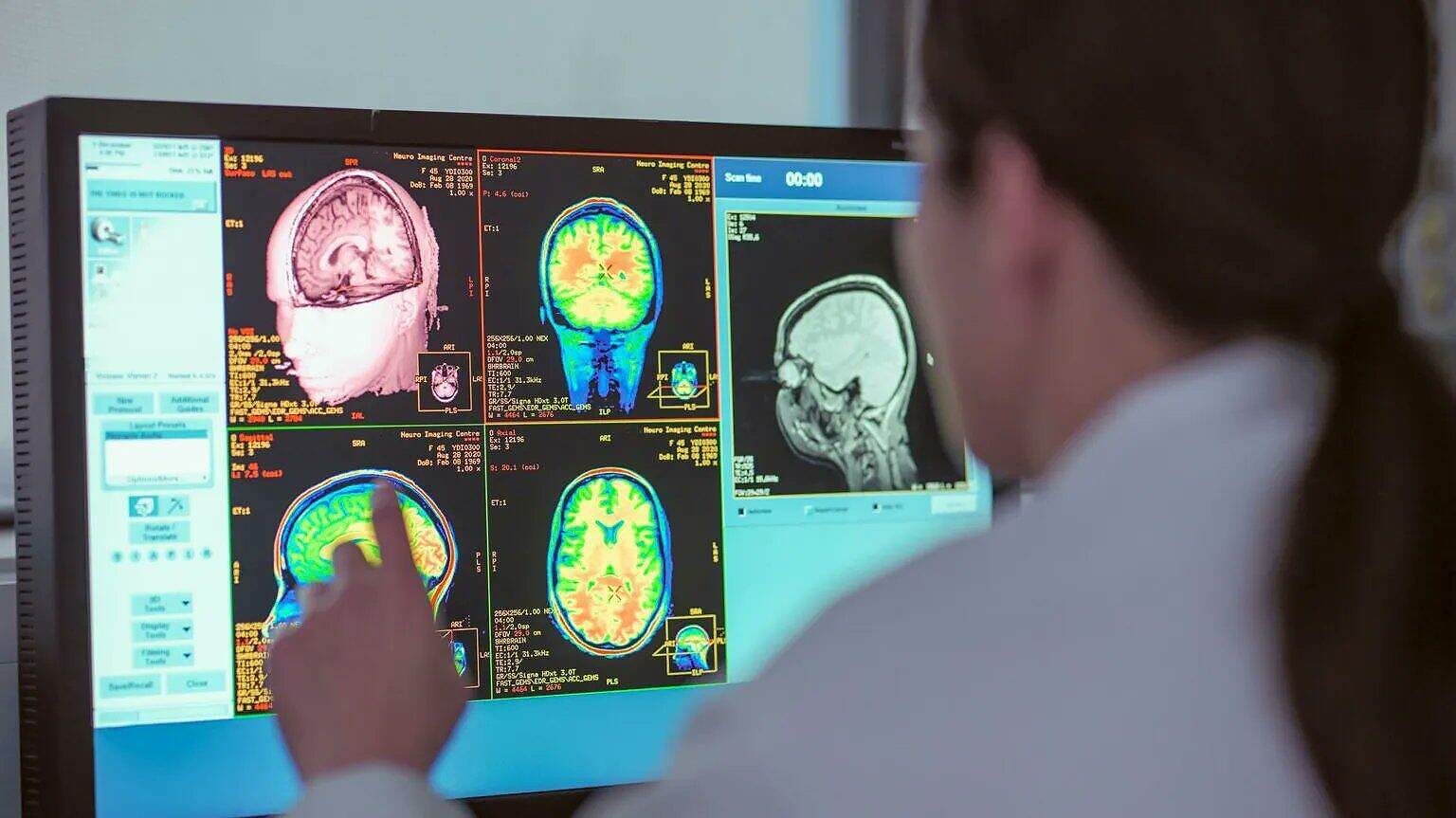 دماغ الإنسان يمر خمس مراحل رئيسية من التغيّرات في بنيته العصبية منذ الطفولة