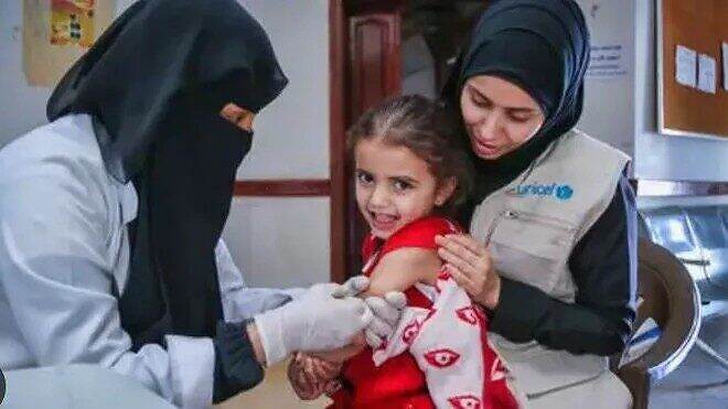 الحصبة تودي بحياة 106 أطفال واصابة 16 ألف في مناطق سيطرة الحكومة المعترف بها
