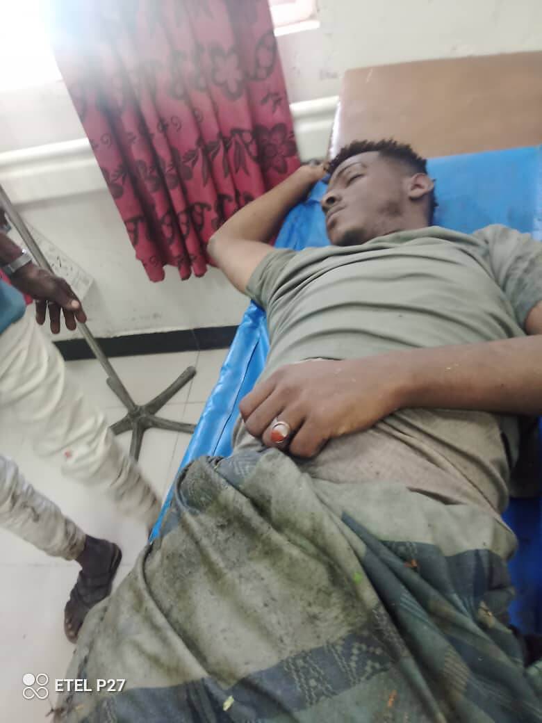 وفاة ثلاثة مواطنين من فئة المهمشين في "بيارة "الصرف الصحي في تعز