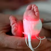 مادتان في البلاستيك ترتبطان بولادات مبكرة ووفاة آلاف المواليد