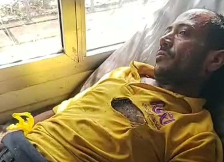 بائع متجول يُحرق جسده احتجاجاً على الجبايات في مدينة التربة بتعز