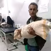 وفاة طفلة في تعز بعد ست ساعات من الانتظار داخل مستشفى اليمني السويدي