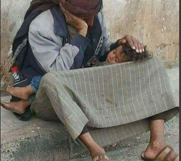 انعدام الأمن الغذائي يهدد 5 ملايين شخص في مناطق الحكومة اليمنية المعترف بها دولياً