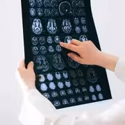 الضمور الدماغي المرتبط بالشيخوخة والطرق والخيارات لمواجهته