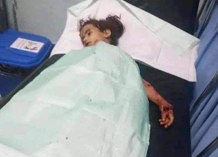 مقتل 4 أطفال وإصابة 13 آخرين بانفجار لغم من مخلفات الحرب شمال الضالع