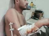 اتهامات لمحور تعز العسكري بخصم مرتبات الجنود رغم تصاعد المعارك في المدينة.