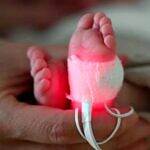 مادتان في البلاستيك ترتبطان بولادات مبكرة ووفاة آلاف المواليد